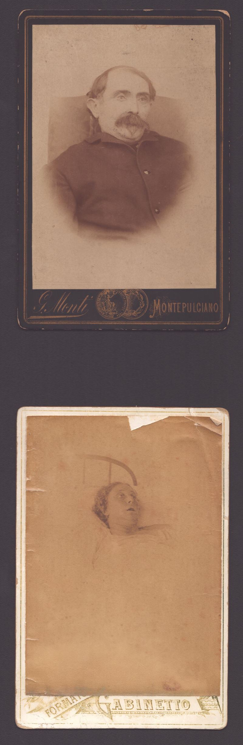 Coppia di Carte-de-visite Post Mortem, Ca. 1890