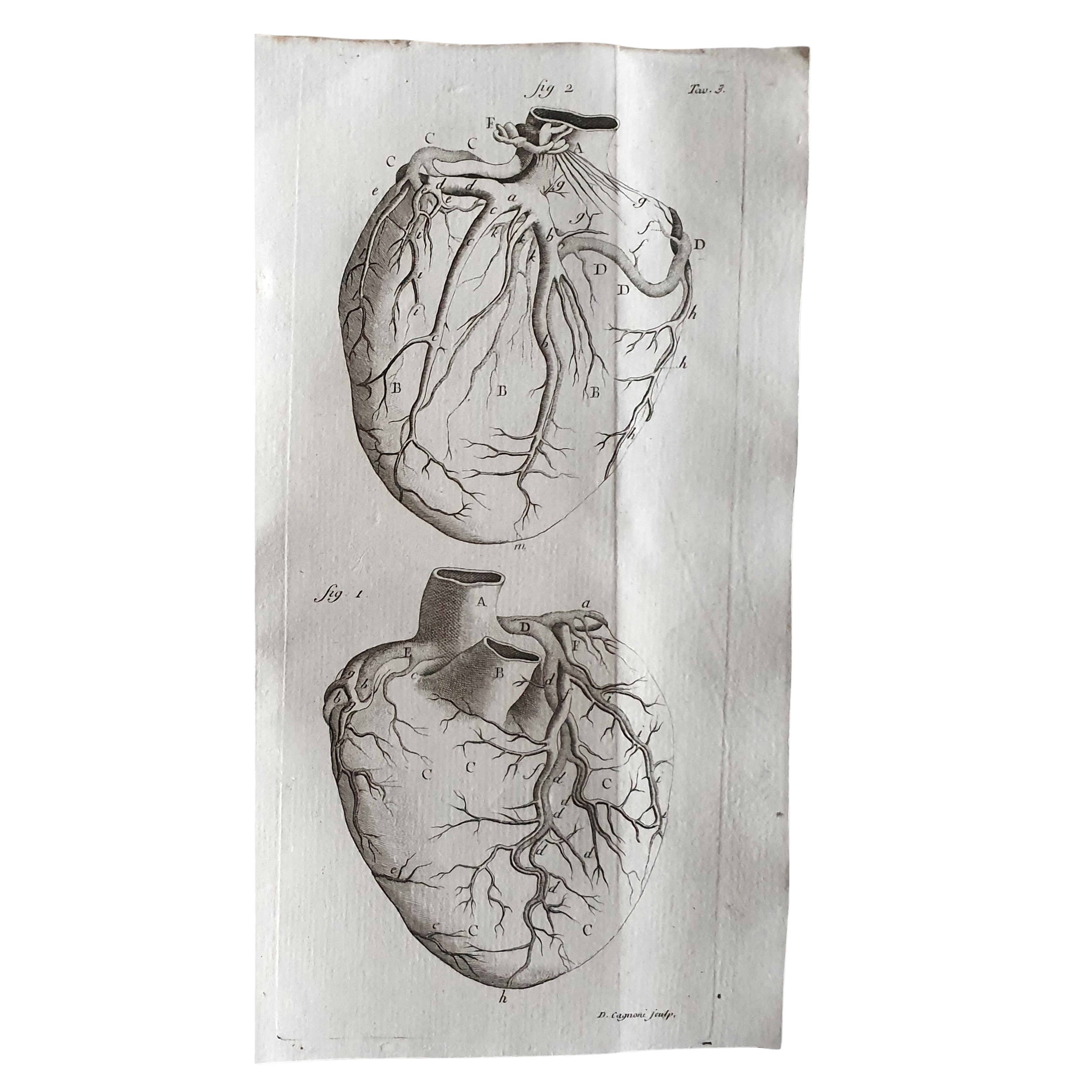 SENAC, JEAN BAPTISTE. Trattato della struttura del cuore della sua azione e delle sue infermità d...